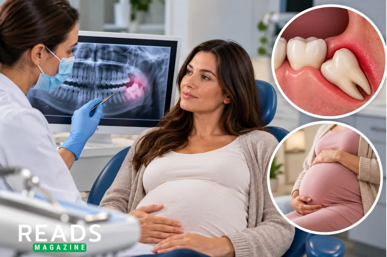 Wisdom Tooth Removal During Pregnancy
